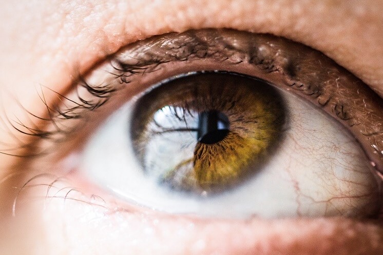 Jak szybko usunąć zaczerwienienie oczu w domu 15